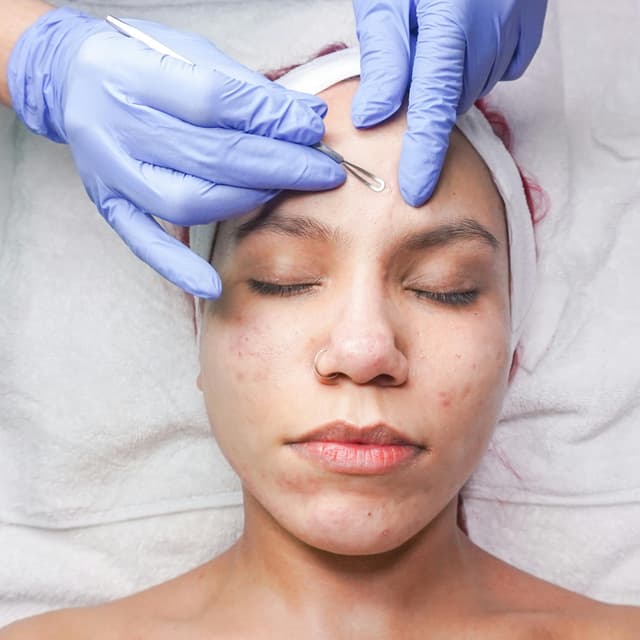 Clear Skin Lite at Wendy Will Esthetics in Culver City, CA