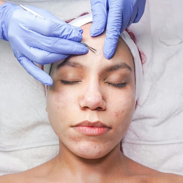 Clear Skin Series at Wendy Will Esthetics in Culver City, CA
